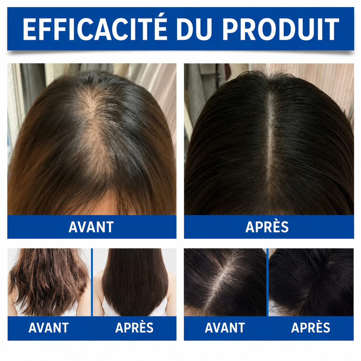 Retrouvez Vos Cheveux Épais et Votre Confiance en 10 Semaines : Sérum Anti-Calvitie certifié.