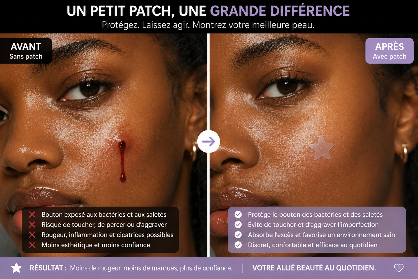 Les Patchs Hydrocolloïdes Anti-Imperfections certifiés: Soignez-vous et rendez-vous plus Professionnel !